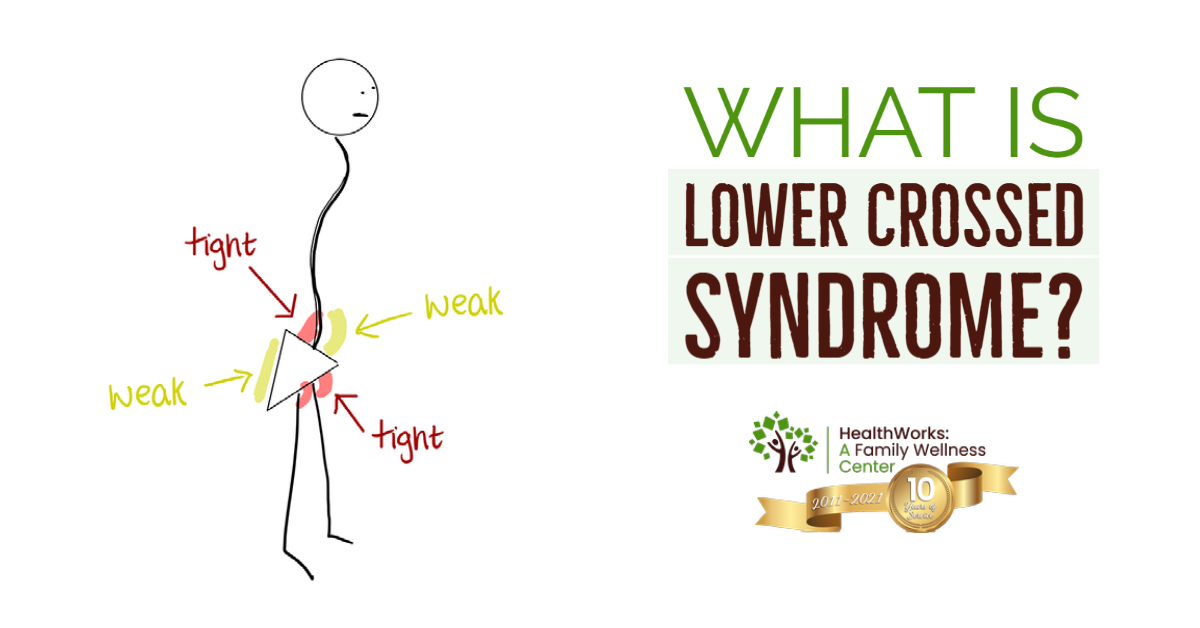 What Is Lower Crossed Syndrome 