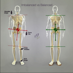 Imbalanced vs balanced