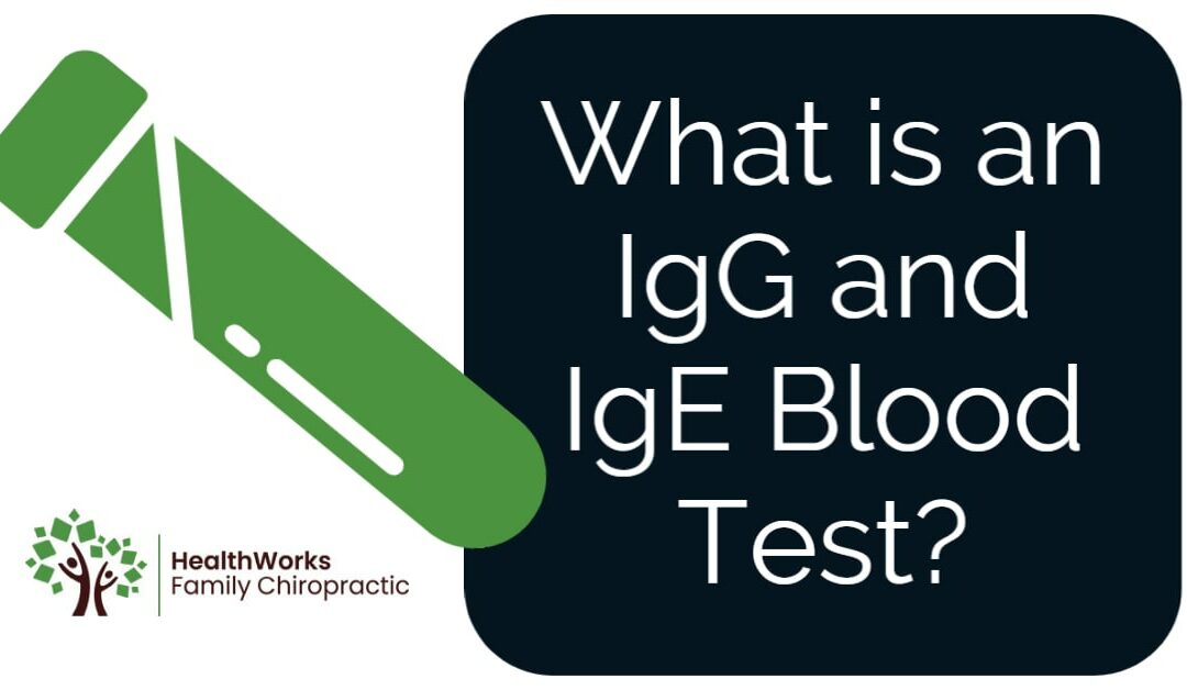 What is an IgG and IgE blood test?